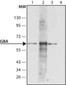 Anti-Glucocerebrosidase (C-terminal) antibody produced in rabbit ~1 mg/mL, affinity isolated antibody, buffered aqueous solution