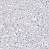 Anti-FLG antibody produced in rabbit Prestige Antibodies® Powered by Atlas Antibodies, affinity isolated antibody, buffered aqueous glycerol solution, ab3