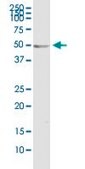 Monoclonal Anti-ODC1 antibody produced in mouse clone 2G5, purified immunoglobulin, buffered aqueous solution