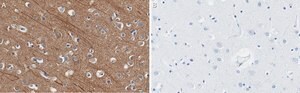Anti-Presenilin-1 Antibody, clone 2O13 ZooMAb® Rabbit Monoclonal recombinant, expressed in HEK 293 cells