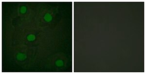 Anti-p53 antibody produced in rabbit affinity isolated antibody