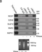 抗-REST抗体 Upstate®, from rabbit