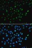 Anti-SMARCA4 antibody produced in rabbit affinity isolated antibody