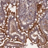 Anti-TMC5 antibody produced in rabbit Prestige Antibodies® Powered by Atlas Antibodies, affinity isolated antibody, buffered aqueous glycerol solution