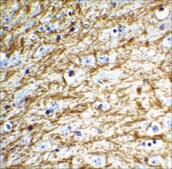 Anti-Clusterin antibody produced in rabbit affinity isolated antibody, buffered aqueous solution