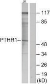 Anti-PTHR1 antibody produced in rabbit affinity isolated antibody