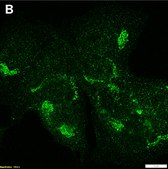 Anti-α-amylase Antibody, clone 1G14 ZooMAb® Rabbit Monoclonal recombinant, expressed in HEK 293 cells