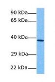 Anti-GNAI1 antibody produced in rabbit affinity isolated antibody