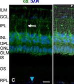 Anti-Glutamine Synthetase Antibody, clone GS-6 clone GS-6, Chemicon®, from mouse