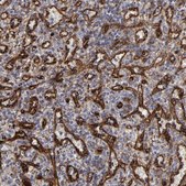 Anti-SLC9A3R2 antibody produced in rabbit Prestige Antibodies® Powered by Atlas Antibodies, affinity isolated antibody, buffered aqueous glycerol solution