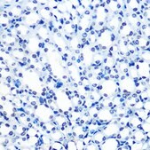 Anti-ADAR1 antibody produced in rabbit