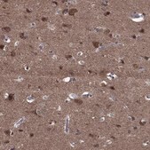 Anti-STMN1 antibody produced in rabbit Prestige Antibodies® Powered by Atlas Antibodies, affinity isolated antibody, buffered aqueous glycerol solution