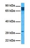 Anti-PARP2 affinity isolated antibody