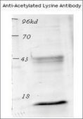 抗-乙酰化赖氨酸 兔抗 1 mg/mL, affinity isolated antibody