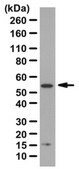 Anti-CCN1/CYR61 Antibody from rabbit, purified by affinity chromatography