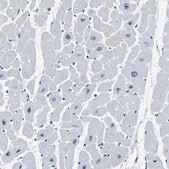 Anti-PHKG1 antibody produced in rabbit Prestige Antibodies® Powered by Atlas Antibodies, affinity isolated antibody, buffered aqueous glycerol solution