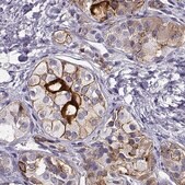 Anti-IGSF1 antibody produced in rabbit Prestige Antibodies® Powered by Atlas Antibodies, affinity isolated antibody, buffered aqueous glycerol solution