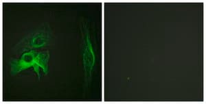 Anti-PAK1 antibody produced in rabbit affinity isolated antibody