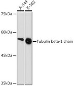 Anti-Tubulin beta-1 chain Antibody, clone 2Z6P1, Rabbit Monoclonal