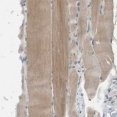 Anti-MAGI2 antibody produced in rabbit Prestige Antibodies® Powered by Atlas Antibodies, affinity isolated antibody, buffered aqueous glycerol solution