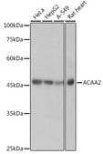 Anti-ACAA2 Antibody, clone 8H6H5, Rabbit Monoclonal