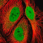 Anti-RPS6KA2 antibody produced in rabbit Prestige Antibodies® Powered by Atlas Antibodies, affinity isolated antibody, buffered aqueous glycerol solution