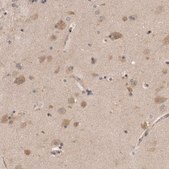 Anti-PSMB2 antibody produced in rabbit Prestige Antibodies® Powered by Atlas Antibodies, affinity isolated antibody, buffered aqueous glycerol solution, Ab1
