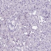 Anti-DBN1 antibody produced in rabbit Prestige Antibodies® Powered by Atlas Antibodies, affinity isolated antibody, buffered aqueous glycerol solution