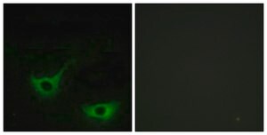 Anti-CALR antibody produced in rabbit affinity isolated antibody