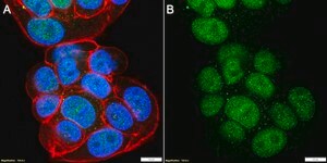 Anti-DYNLL1/PIN Antibody, clone 4B19 ZooMAb® Rabbit Monoclonal recombinant, expressed in HEK 293 cells