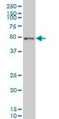 Monoclonal Anti-ALDH2 antibody produced in mouse clone 1E5, purified immunoglobulin, buffered aqueous solution