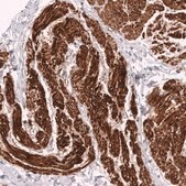 Monoclonal Anti-Myh11 Antibody Produced In Mouse Prestige Antibodies® Powered by Atlas Antibodies, clone CL14619, affinity isolated antibody, buffered aqueous glycerol solution