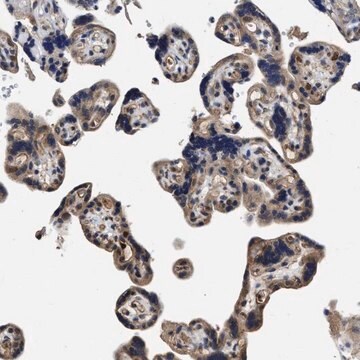 抗-TRAF6 兔抗 Prestige Antibodies® Powered by Atlas Antibodies, affinity isolated antibody, buffered aqueous glycerol solution, Ab1