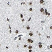 Anti-BCLAF1 antibody produced in rabbit Prestige Antibodies® Powered by Atlas Antibodies, affinity isolated antibody, buffered aqueous glycerol solution