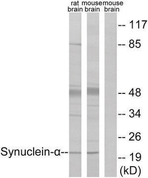 Anti-Synuclein-&#945; antibody produced in rabbit affinity isolated antibody