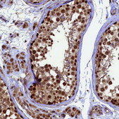 Anti-BRCA1 antibody produced in rabbit Prestige Antibodies® Powered by Atlas Antibodies, affinity isolated antibody, buffered aqueous glycerol solution