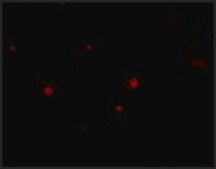 Anti-STIM2 (ab1) antibody produced in rabbit affinity isolated antibody, buffered aqueous solution