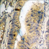 Anti-phospho-Desmin (pSer60) antibody produced in rabbit affinity isolated antibody