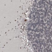 Anti-PSMB2 antibody produced in rabbit Prestige Antibodies® Powered by Atlas Antibodies, affinity isolated antibody, buffered aqueous glycerol solution, Ab2