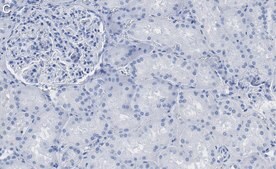 Anti-Aquaporin-1 Antibody, clone 2I7 ZooMAb® Rabbit Monoclonal recombinant, expressed in HEK 293 cells