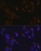 Anti-CD133 antibody produced in rabbit