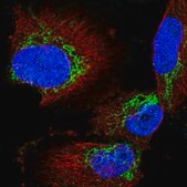 Anti-AGK antibody produced in rabbit Prestige Antibodies® Powered by Atlas Antibodies, affinity isolated antibody, buffered aqueous glycerol solution