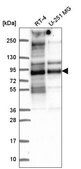 Anti-TACC2 antibody produced in rabbit Prestige Antibodies® Powered by Atlas Antibodies, affinity isolated antibody
