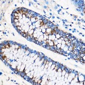 Anti-ATF6 antibody produced in rabbit